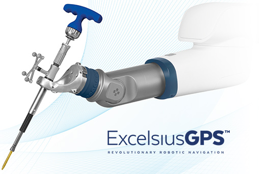 ExcelsiusGPS Robotic Navigation Spine