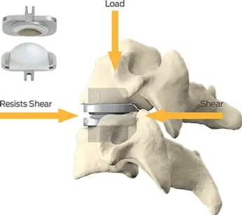 prodisc-c Mechanism img